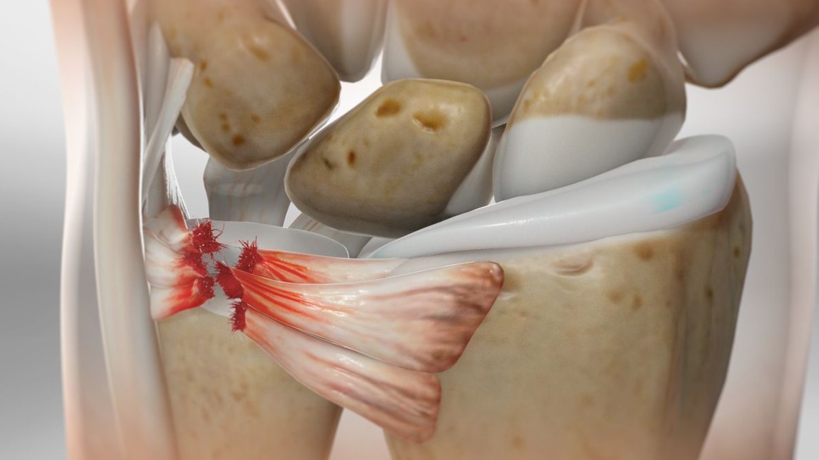 Triangular Fibrocartilage 